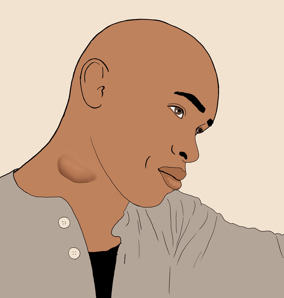 En tegneserie av en person med kul på halsen