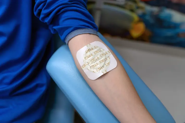 Arm med emla-plaster