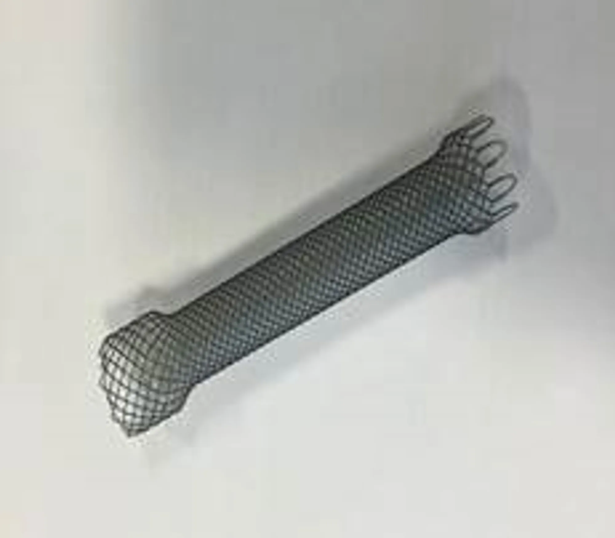 Foto av stent, eit røyr, vanlegvis utforma som eit nett i metall eller kunststoff.