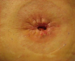 Et nærbilde av en persons øye