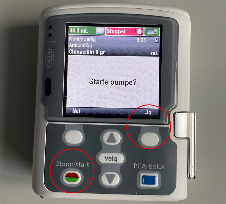 Et nærbilde av en mobiltelefon