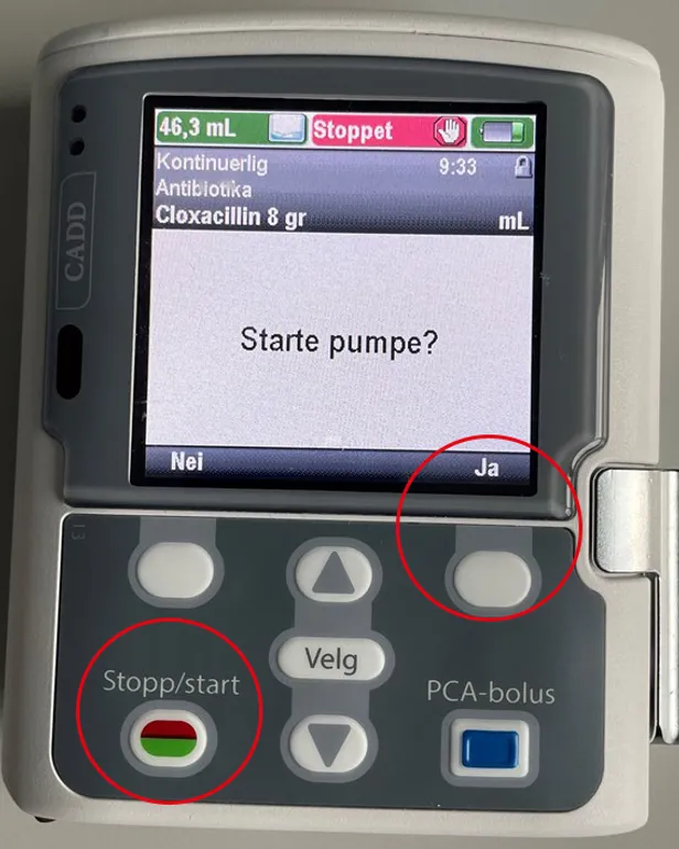 Et nærbilde av en mobiltelefon