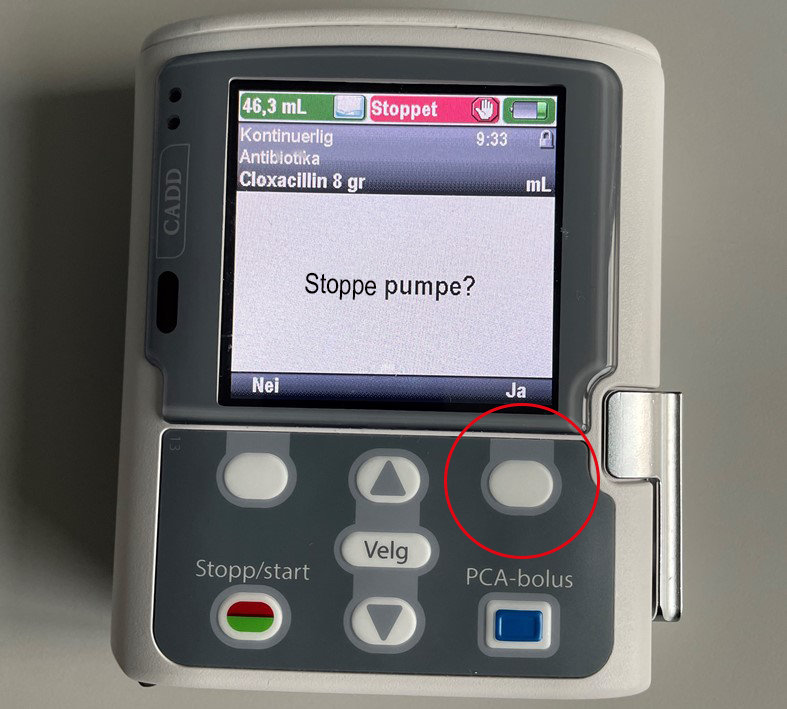 Et nærbilde av en mobiltelefon