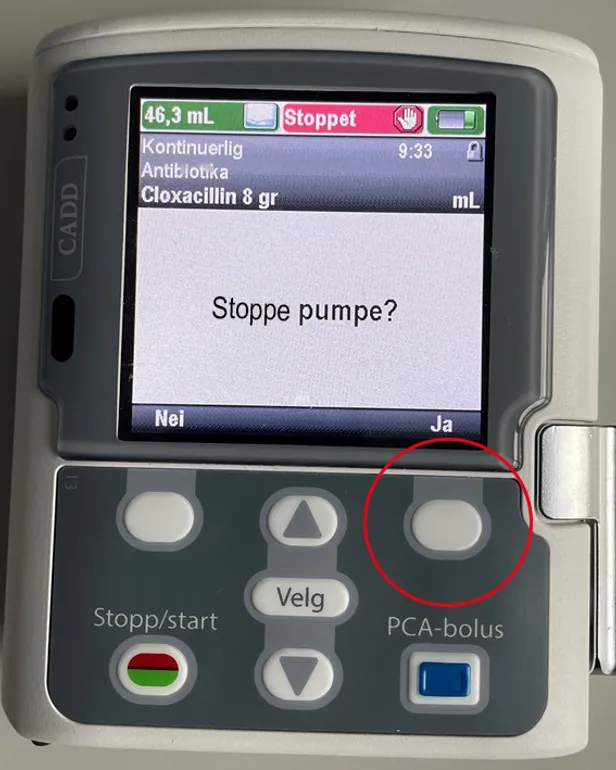 Et nærbilde av en mobiltelefon
