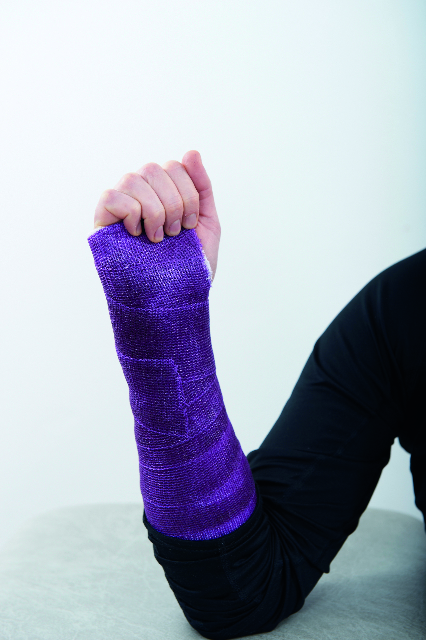 En gipset arm og knyttet hånd. Lilla bandasje.