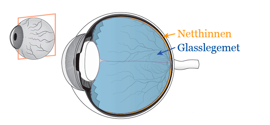 Tegning av øyet med glasslegemet og netthinnen