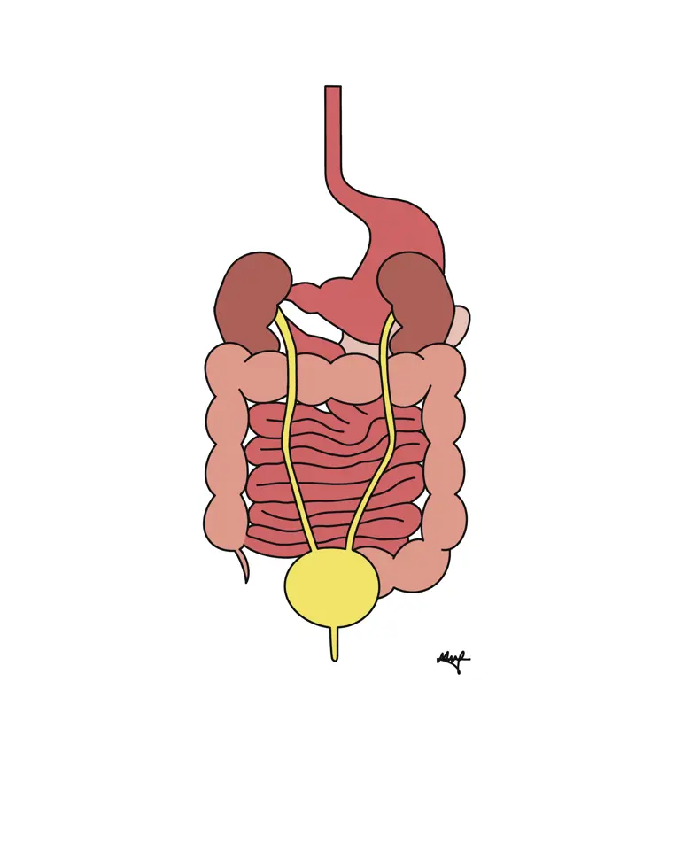 Diagram