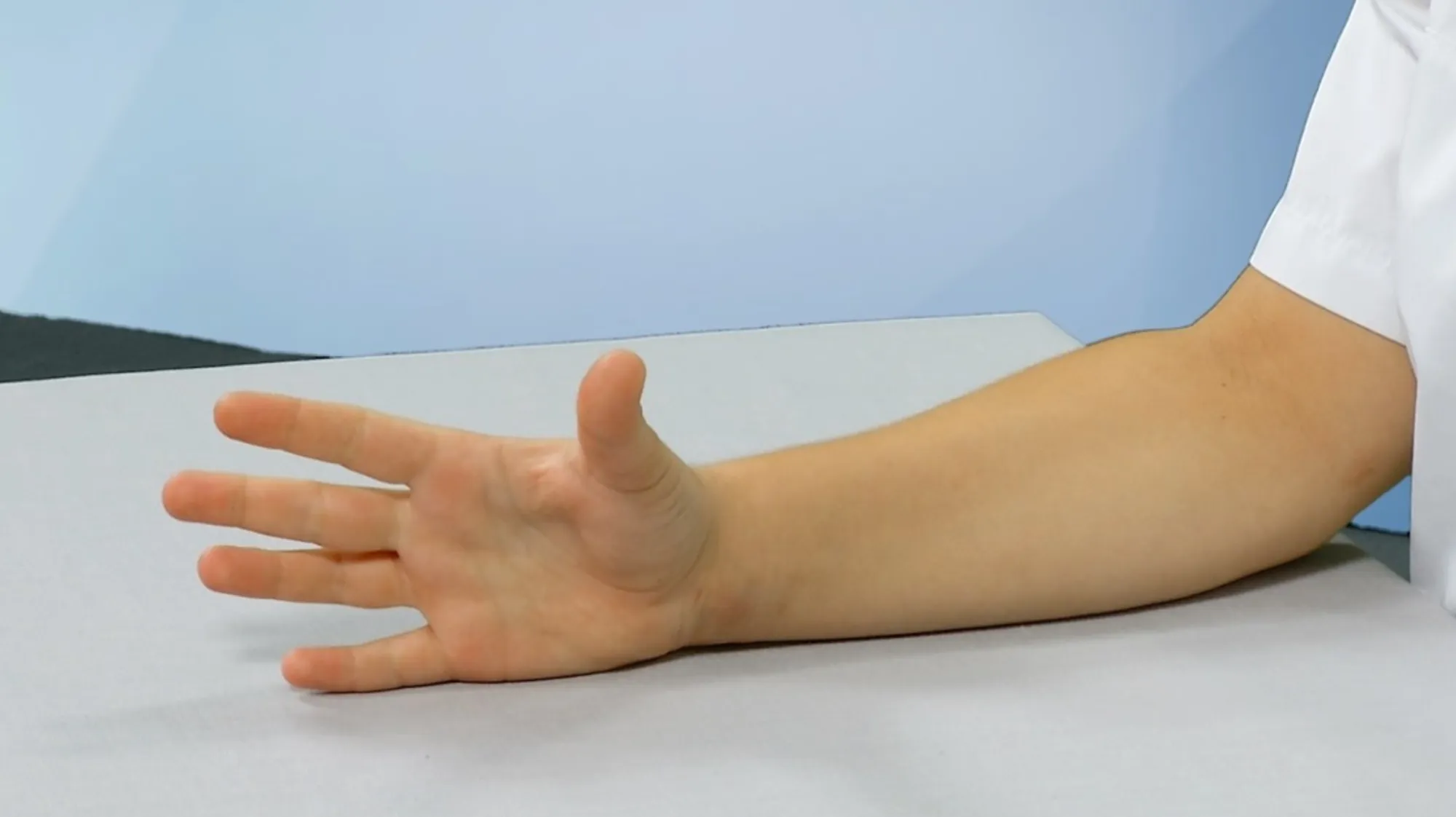 fingre 1