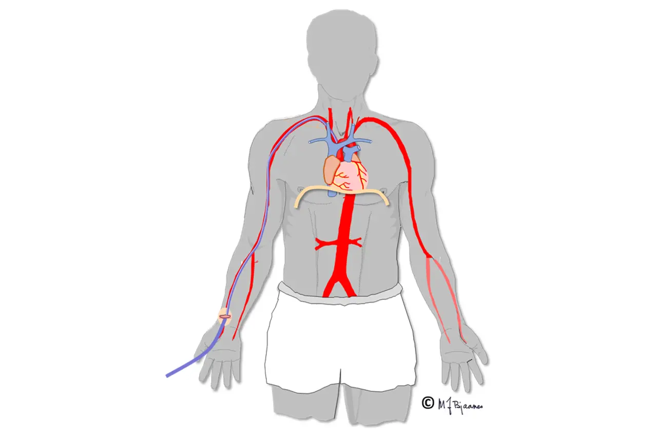 Tegning av blodårer inne i kroppen