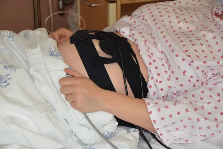 CTG-undersøking av gravid kvinne. Foto