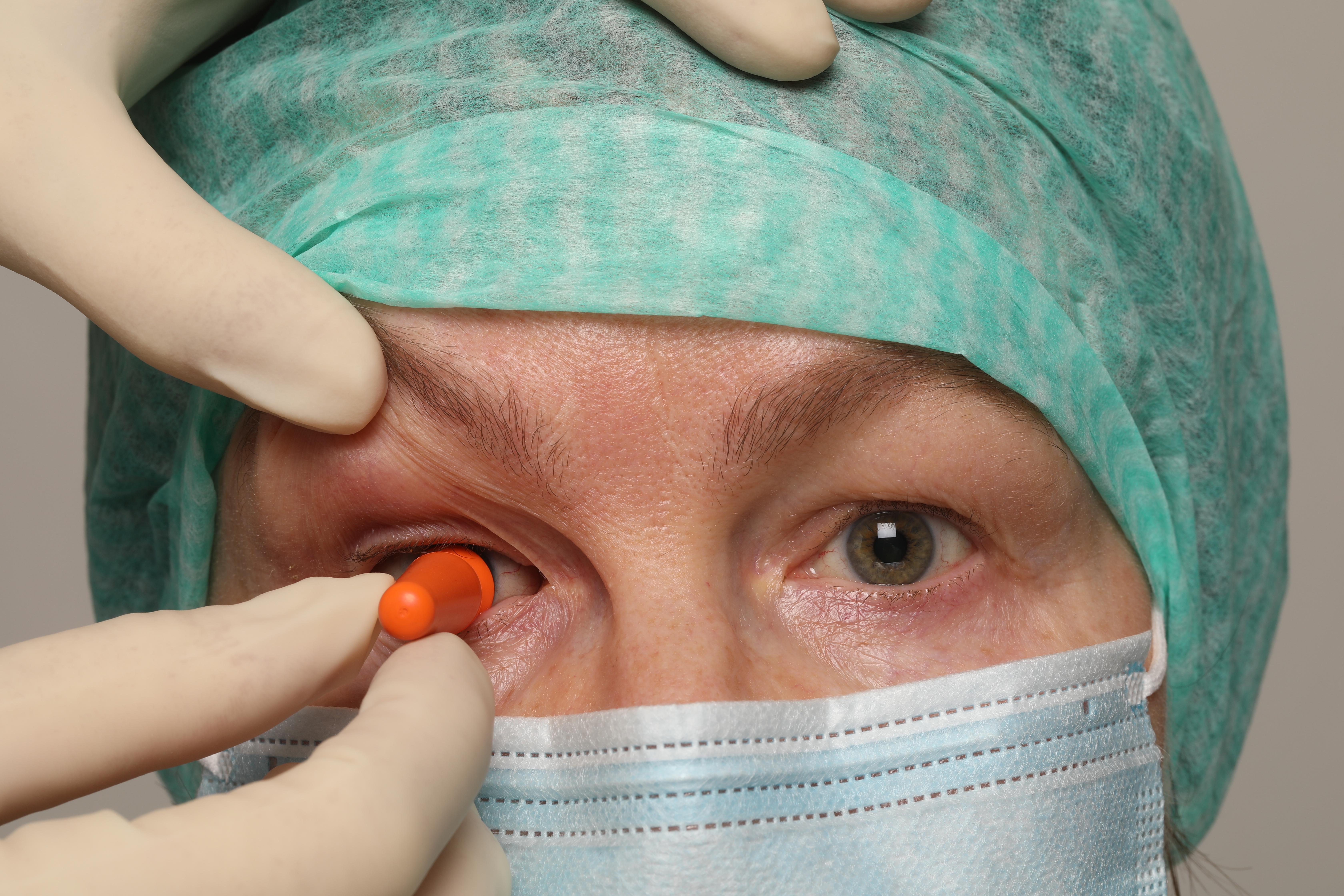 sett inn sugekopp. Bilde.