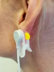 FOto som viser hvordan transkutan sensor festes i øreflippenTranskutan registrering øreflipp.jpg