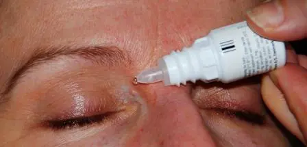 Øyedrypping
