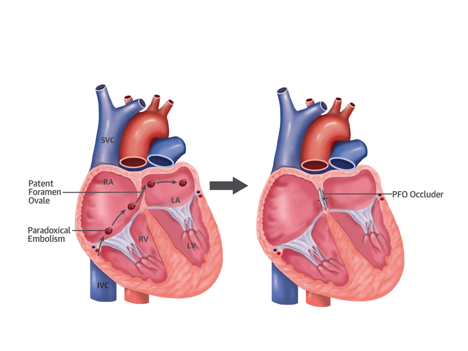 Illustrasjon av to menneskehjerter.