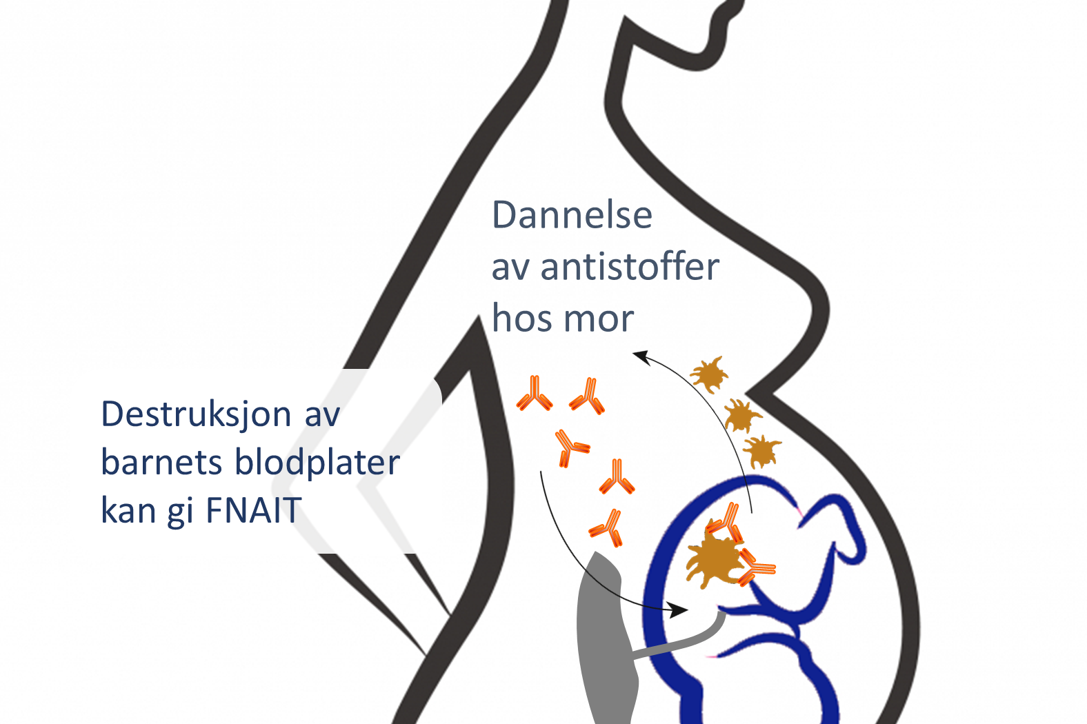 Gravid kvinne med antistoffer som påvirker fosteret.