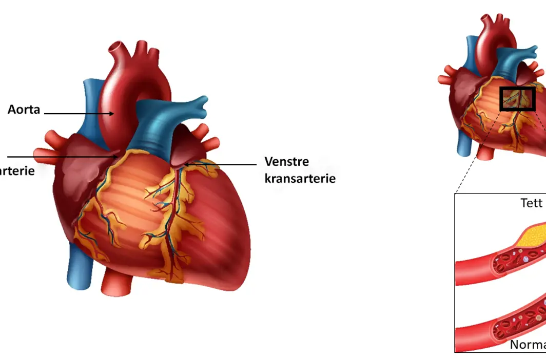 Illustrasjon av hjertets anatomi.