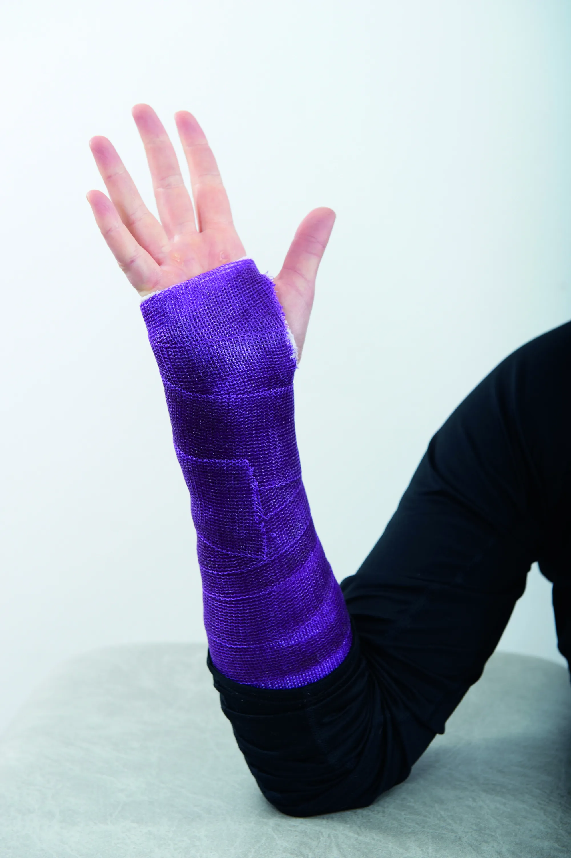 En gipset arm med sprikende fingre