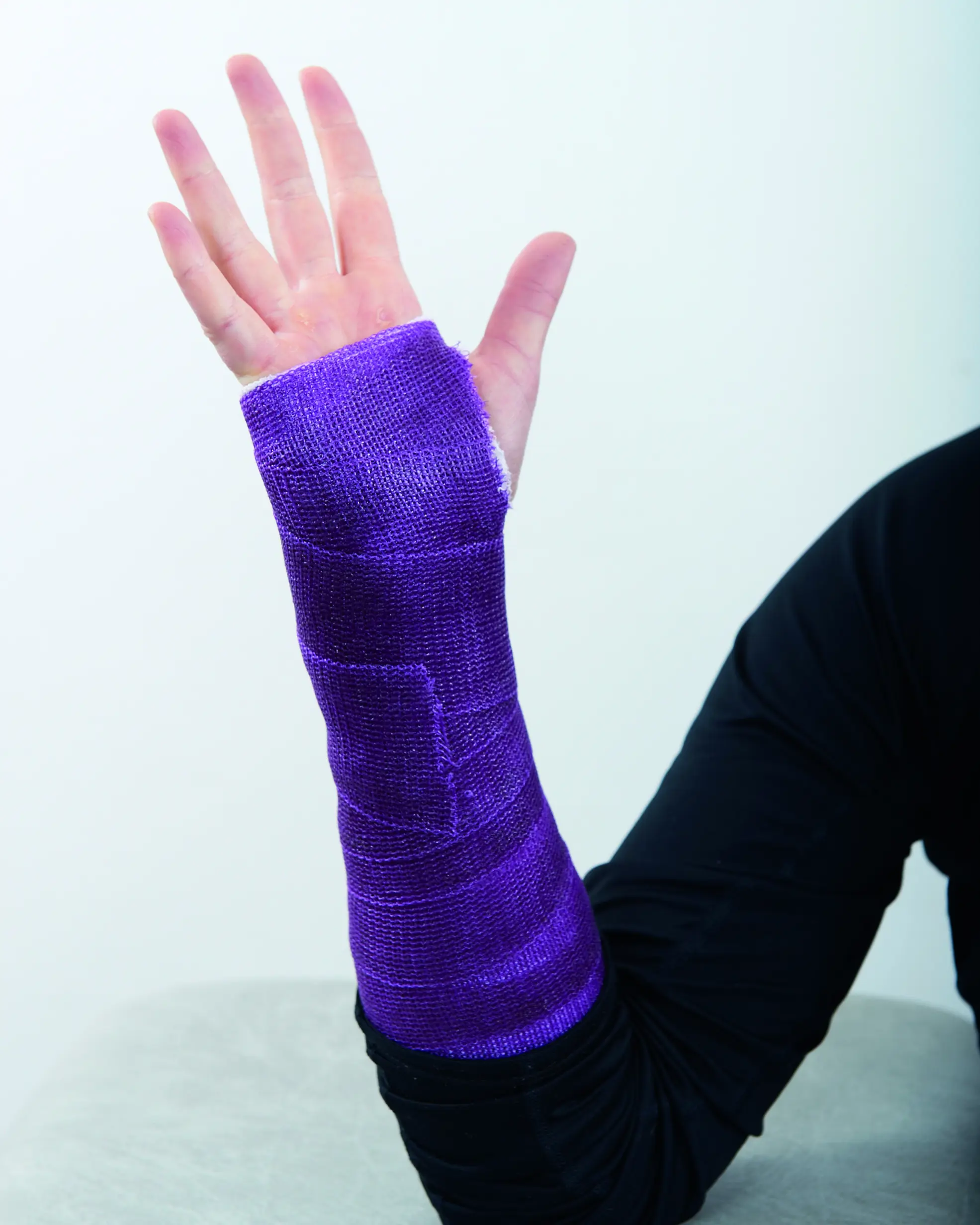 En gipset arm med sprikende fingre
