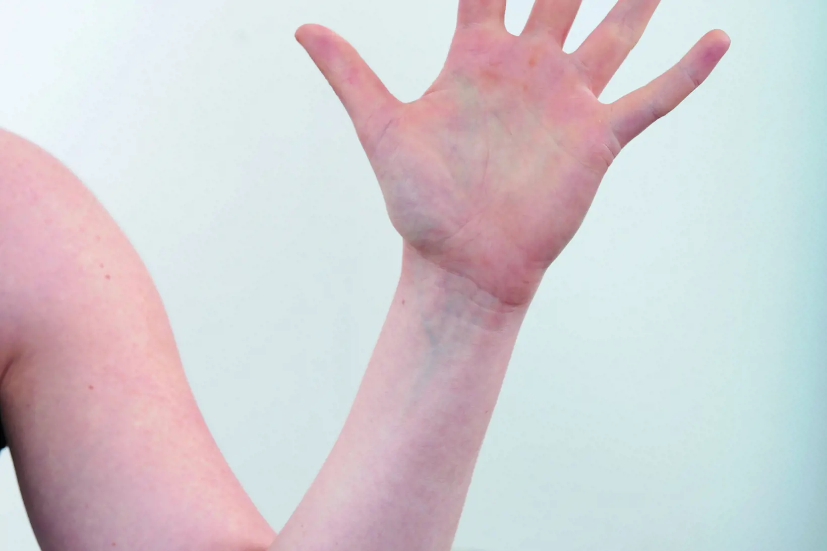Bilde av en hånd med sprikende fingre