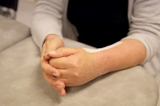 Frisk hånd presser lett på knytt operert hånd for å få fingre inn i håndflaten. Foto