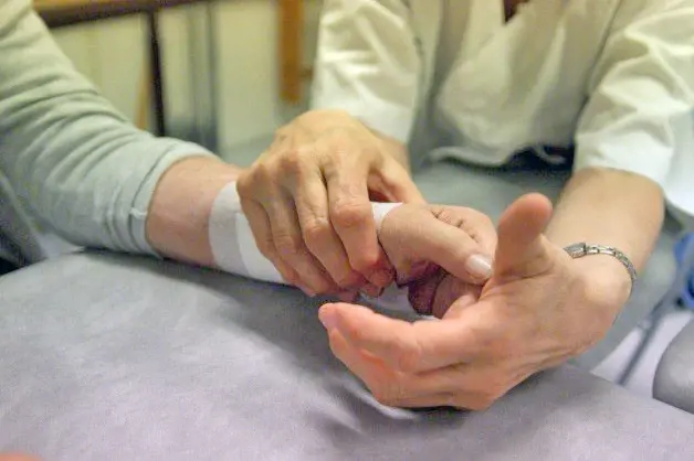 Fysioterapeut hjelper pasient med håndøvelser. Foto