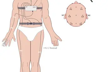 Illustrasjon av menneske med elektroder festet til hodet og kroppen