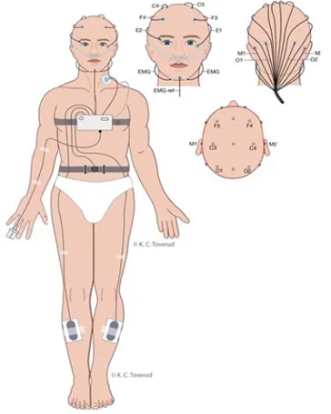 Illustrasjon av menneske med elektroder festet til hode og kropp