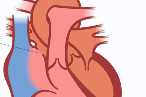 Illustrasjon av hjertet ADS