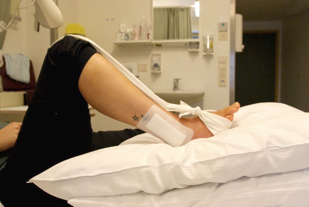 Fot med operert ankel og bøyd kne og slakt bånd. Foto