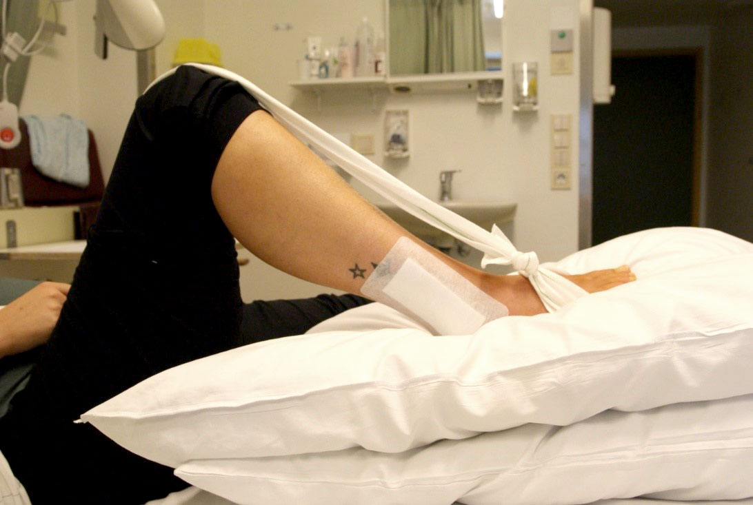 Fot med operert ankel og bøyd kne og avslappet ankelledd. Foto